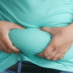 Nonsurgical Fat Reduction: What to Know Before Choosing Fat Freezing Treatments